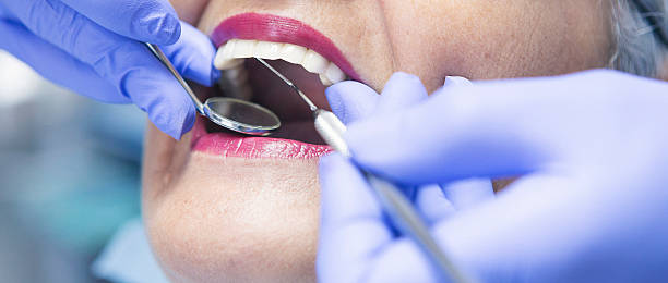 Best Emergency Root Canal Treatment in Toccoa, GA